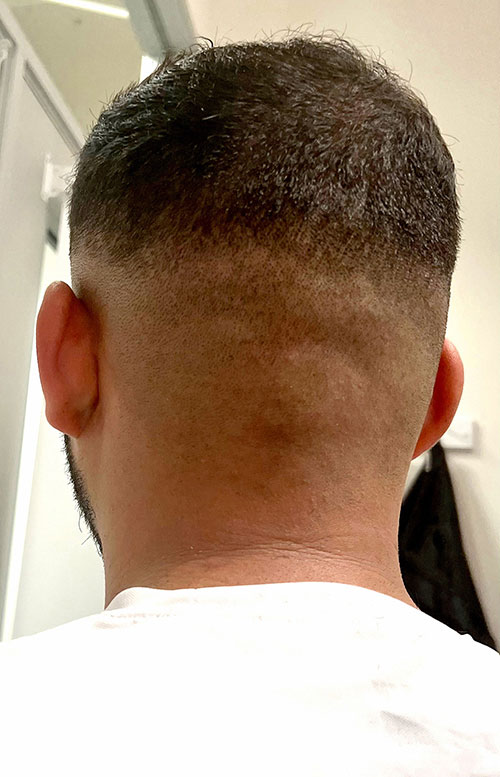 zero fade